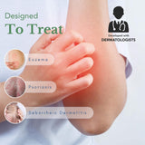 Texture crème apaisante Theraplex AIM appliquée sur une zone irritée