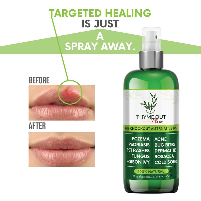 Thyme Out Plus – sensation fraîche lors de l’application