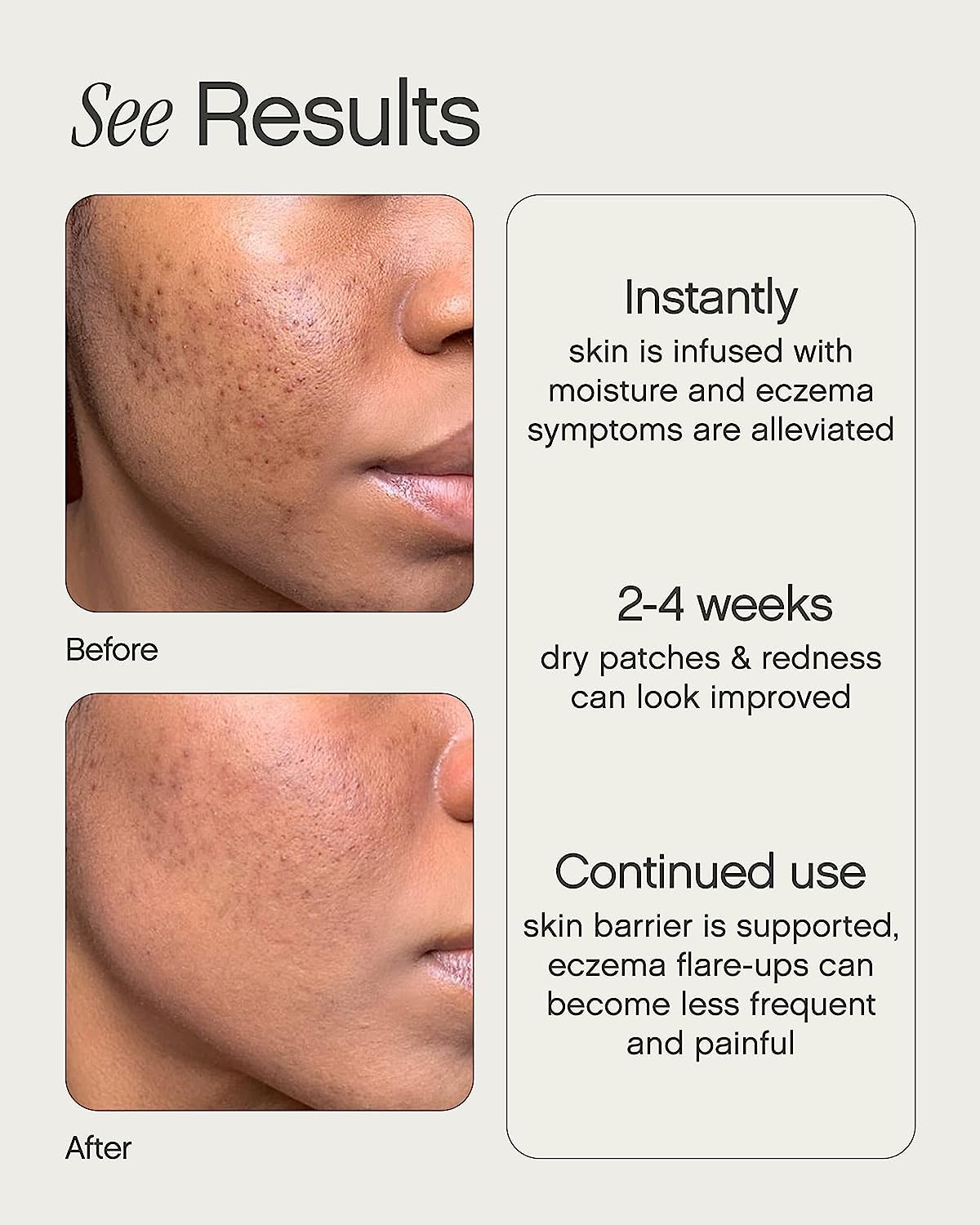 Application sur le visage avec Like Butter pour un confort immédiat.