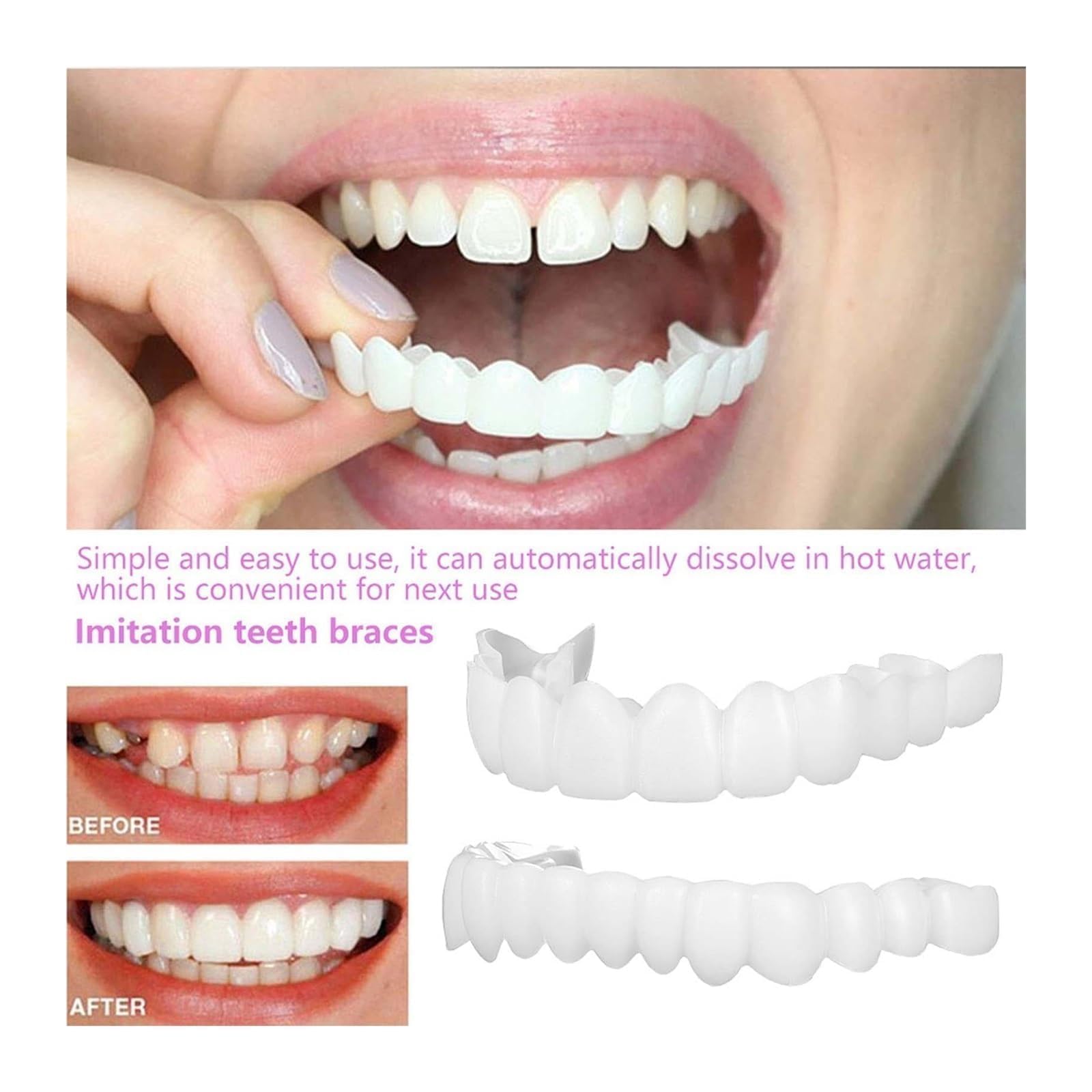 Treayes ensemble top et bottom: ensemble 2 paires pour un sourire harmonieux.