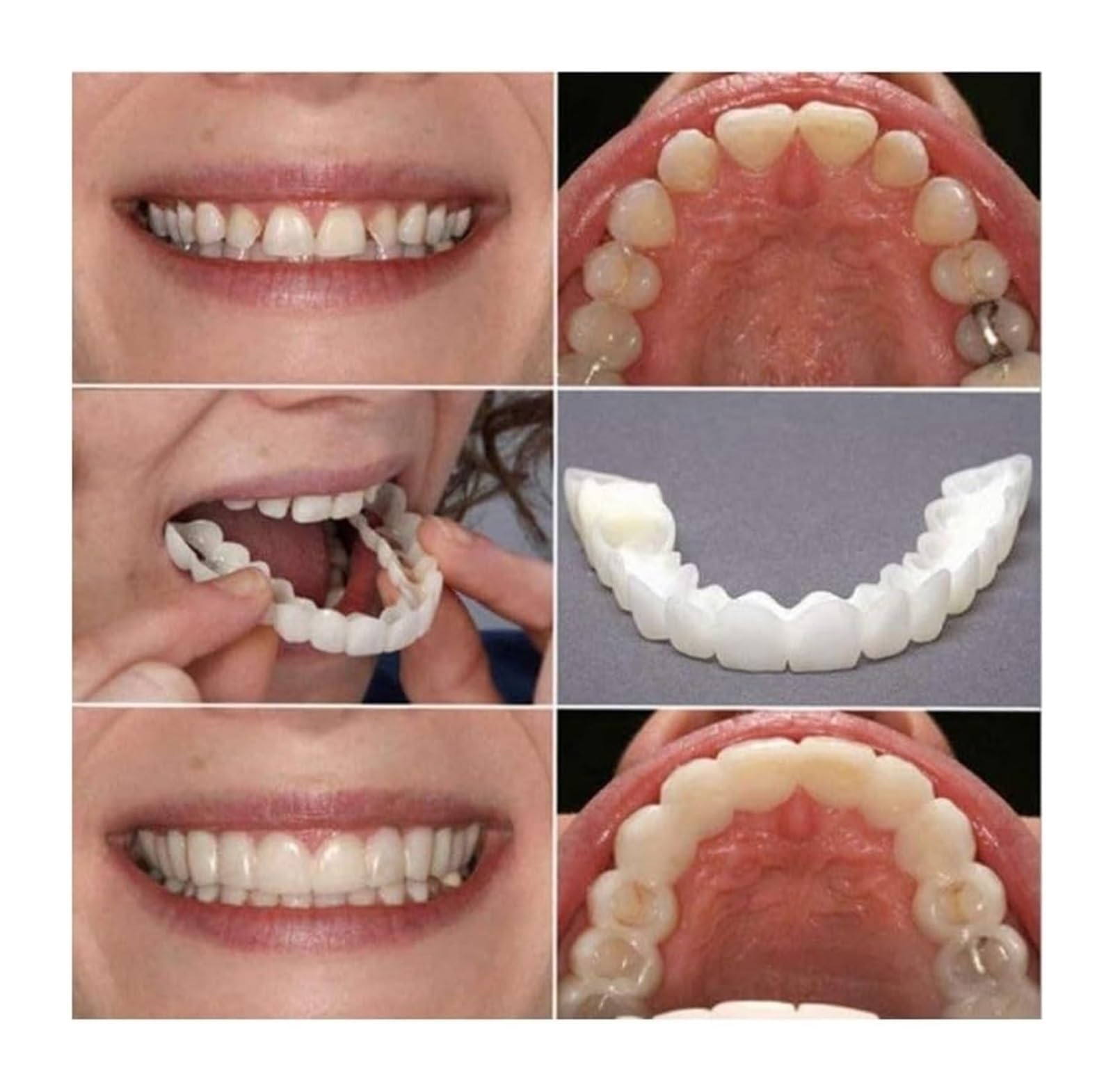 Treayes sourire-confiance-ensemble : éclat temporaire pour une apparence plus confiante.