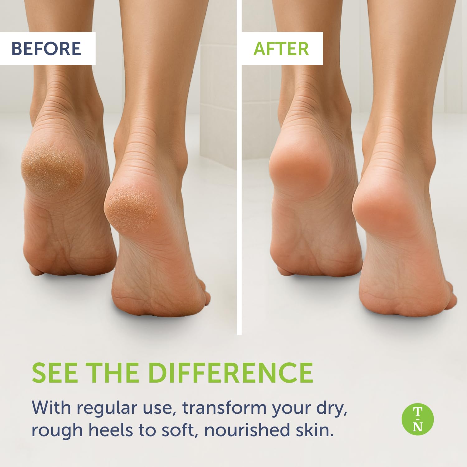 Application sur les pieds avec Remedy Balm pour un soin apaisant.