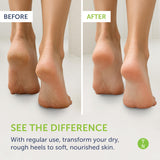 Application sur les pieds avec Remedy Balm pour un soin apaisant.