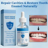 Nudenta Tuyapio mise en œuvre facile sur les dents pour soins à domicile.