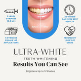 Ultra White emballage pratique avec cinq tubes pour traitement à domicile économique