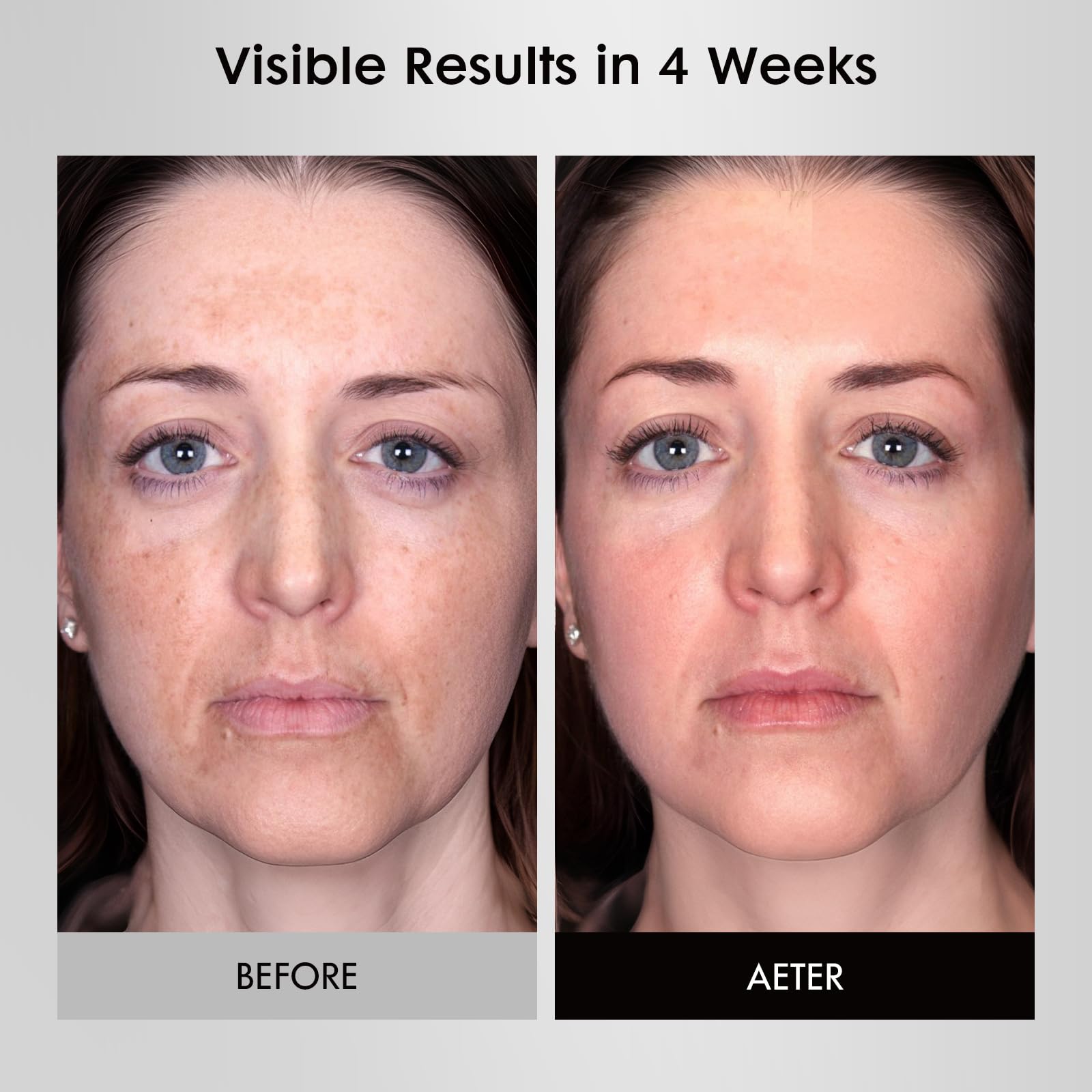Umitec Masque Lumière Visage: silicone doux pour un contact peau agréable.