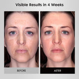 Umitec Masque Lumière Visage: silicone doux pour un contact peau agréable.