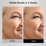 Umitec Masque Lumière Visage: minuterie intégrée pour contrôler la durée.