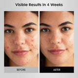 Umitec Masque Lumière Visage: design léger et portable pour voyager.