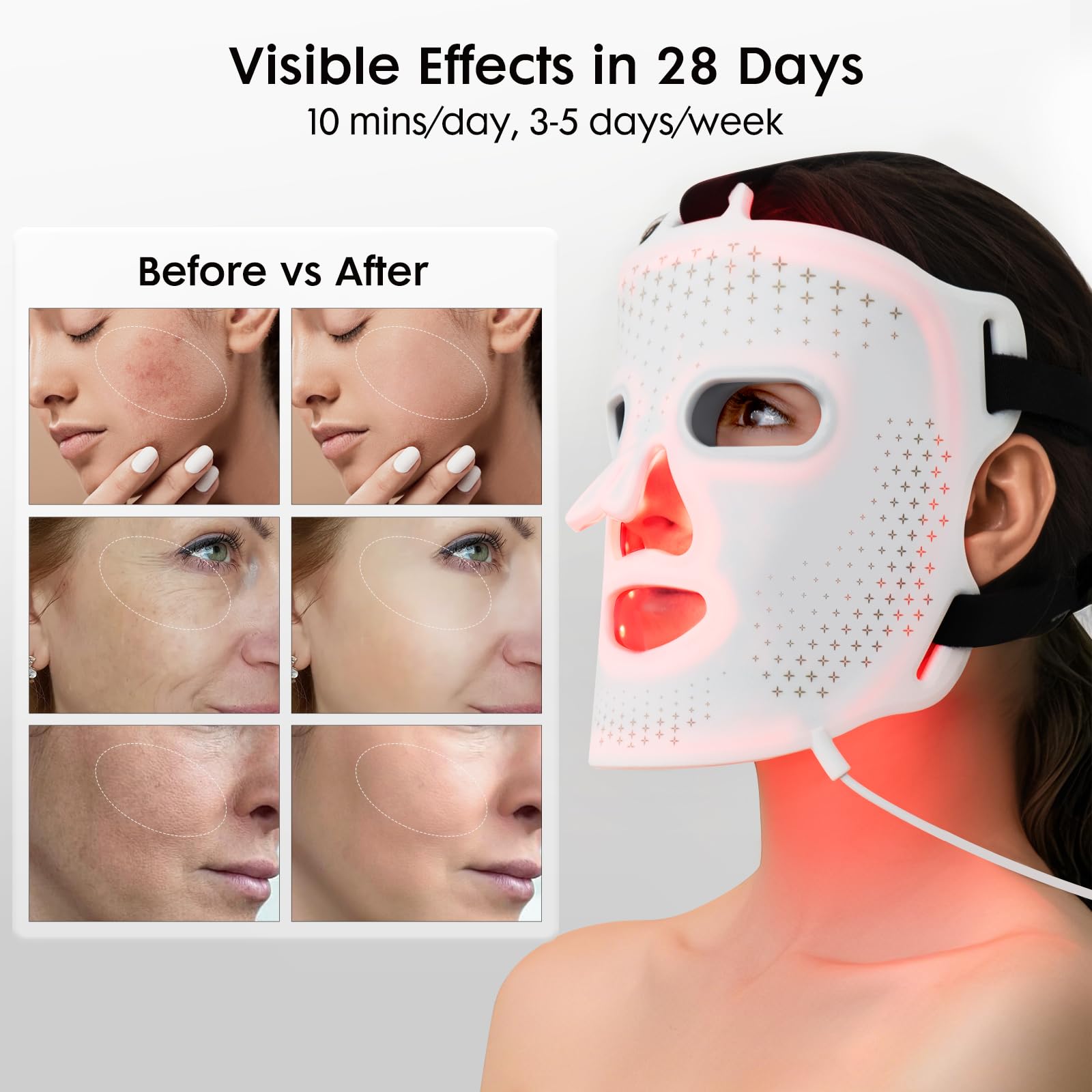 Umitec Masque Lumière Visage: protection oculaire pendant les séances.
