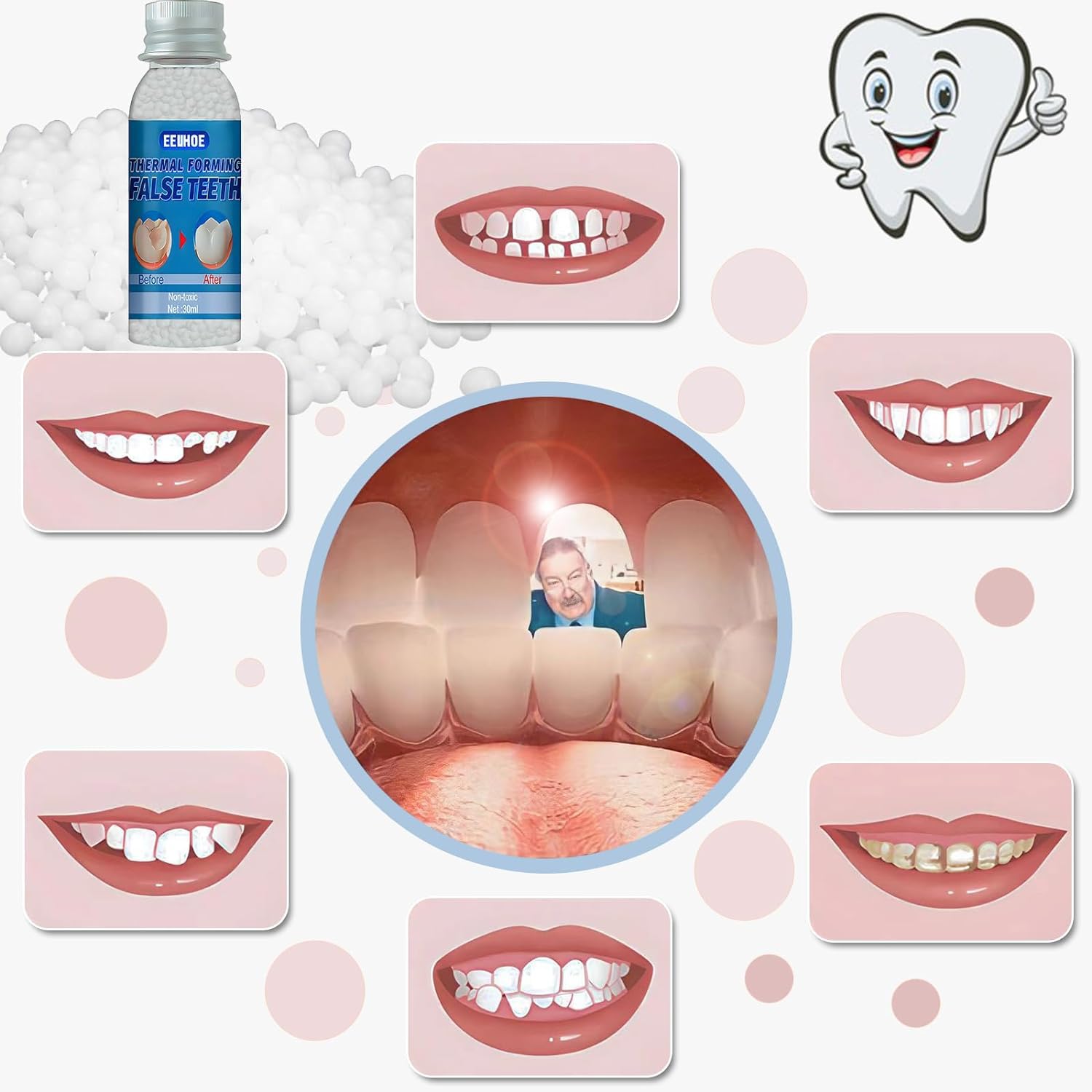VEZE Modelage-dent-provisoire-pate-moulable : rendu plus naturel.