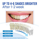 VieBeauti Stylo Blanchiment Dents tube transparent pour suivre le niveau restant