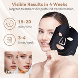 VINCAOR Masque LED pour domicile et voyage, routine pratique.