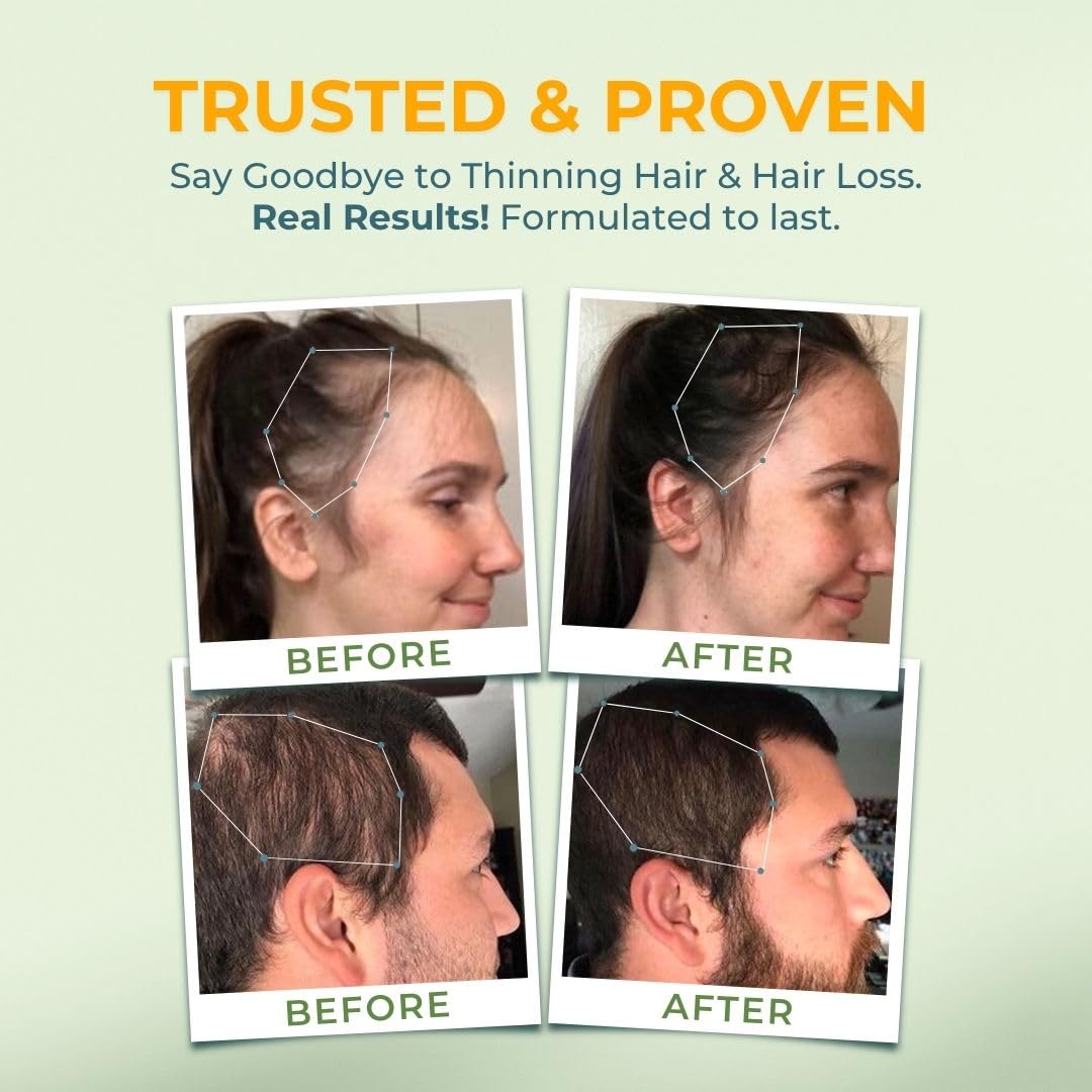 Vital Hair Complex — rituel quotidien avec deux capsules par jour.