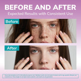 Vitalibre Biotine Plus — kératine et nutriments pour cheveux et ongles renforcés.