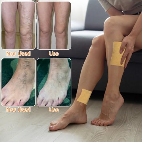 Wanban Curcuma Patch Varices Spider — confort ciblé pour les veines superficielles
