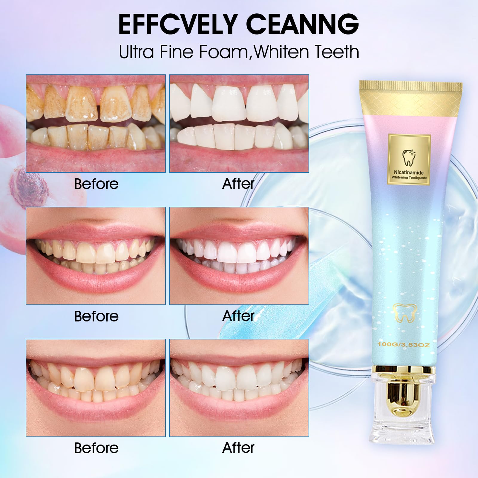 Wandyme dentifrice niacinamide – réduction des taches café et thé sur les dents