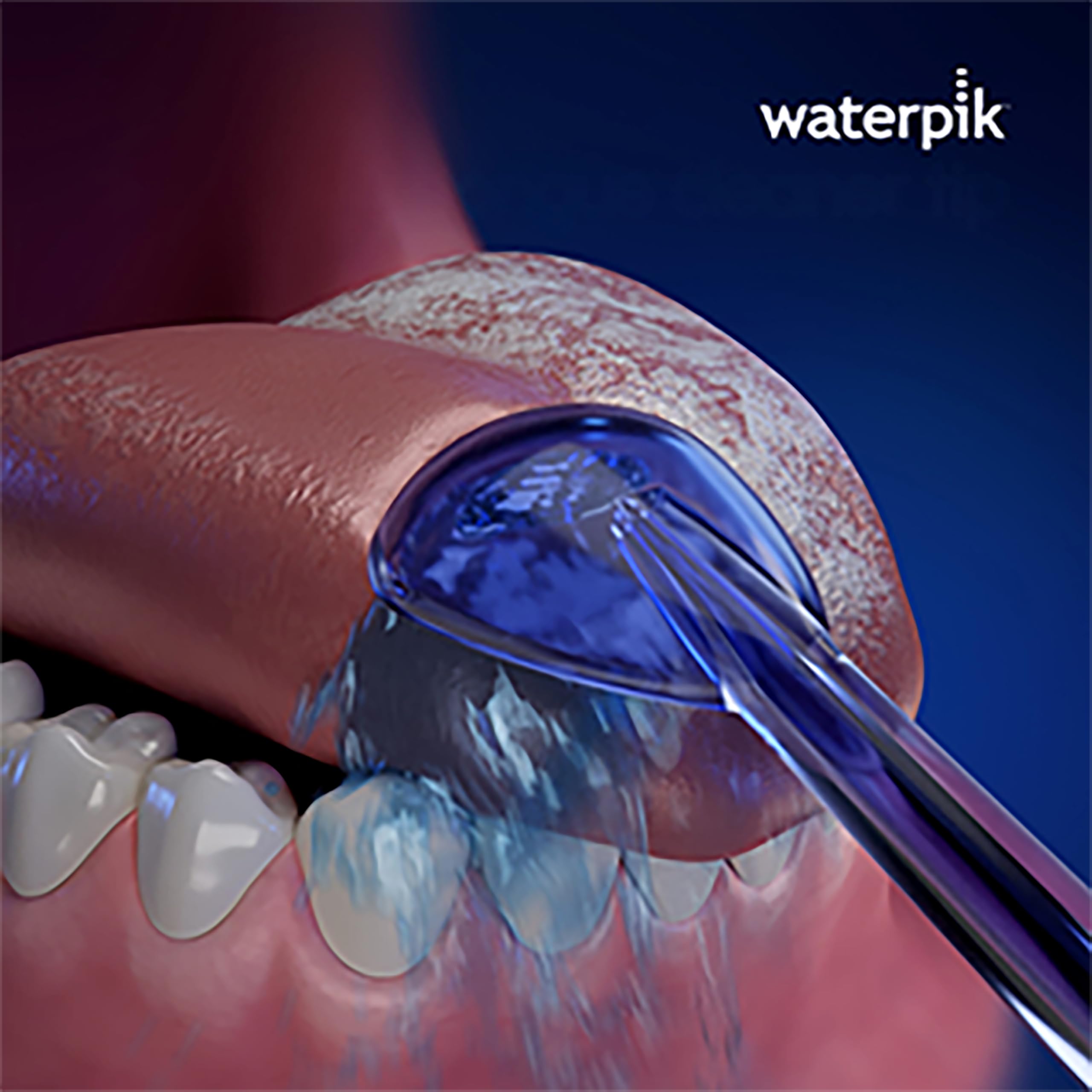 Waterpik accessoire hygiène buccale compatible avec flosser Waterpik