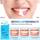 Waving Palms bandes: application facile 30-60 minutes pour sourire plus clair