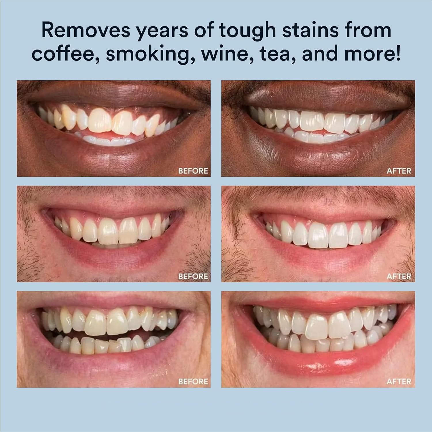 White Smile: boite-emballage élégante prête à offrir ou stocker