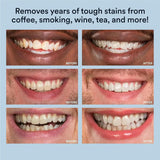 White Smile: boite-emballage élégante prête à offrir ou stocker