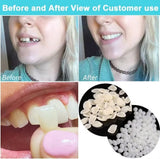 Womcare dent artificielle moulage flexible pour modelage rapide.