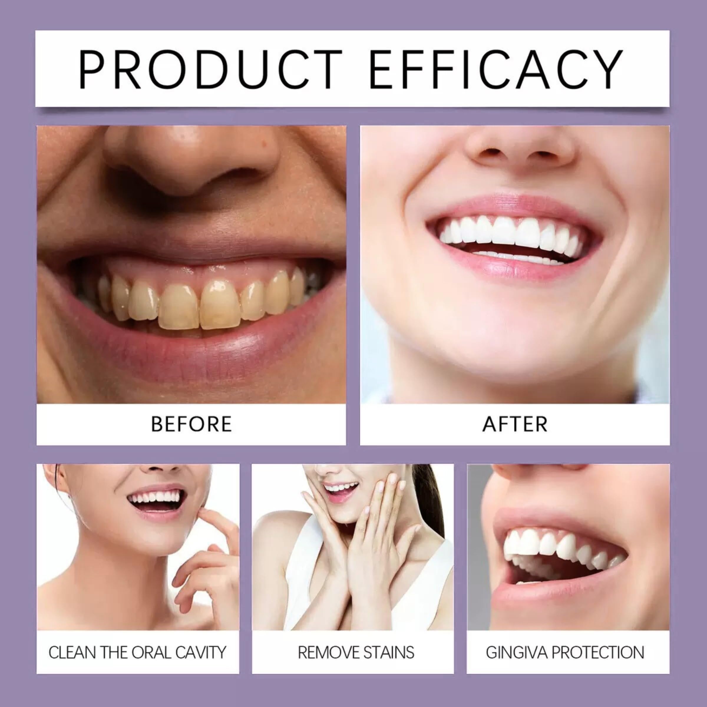 XYFSZDQJZHG protection des gencives, soin buccal quotidien