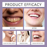 XYFSZDQJZHG protection des gencives, soin buccal quotidien
