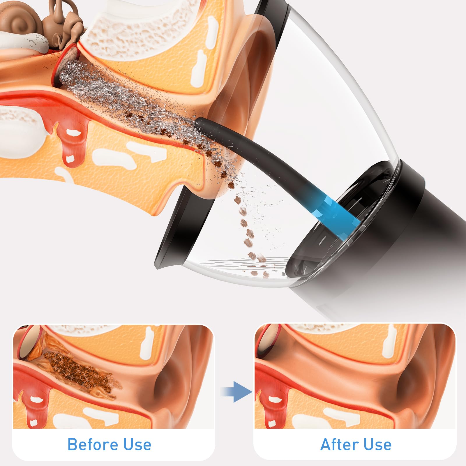 Yakbio irrigateur oreille IPX6 prêt à une utilisation sous douche