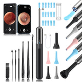 Yorsfun caméra d’otoscope 1080P avec objectif 3 MP pour le conduit auditif.