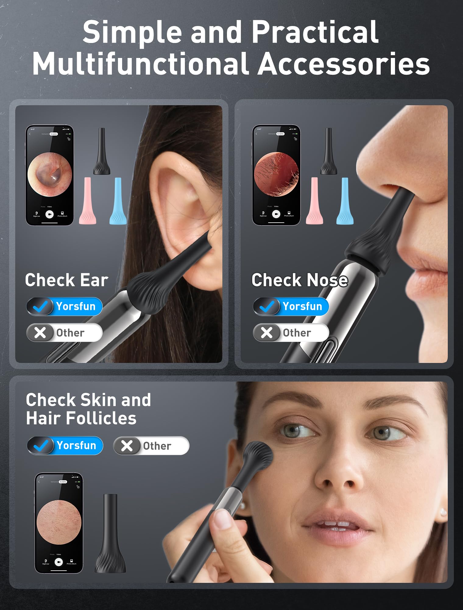 Vue 360 du conduit auriculaire avec la caméra Yorsfun.
