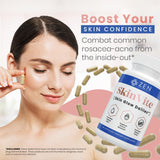 Curcuma et probiotiques dans SkinVite pour une routine beauté naturelle.