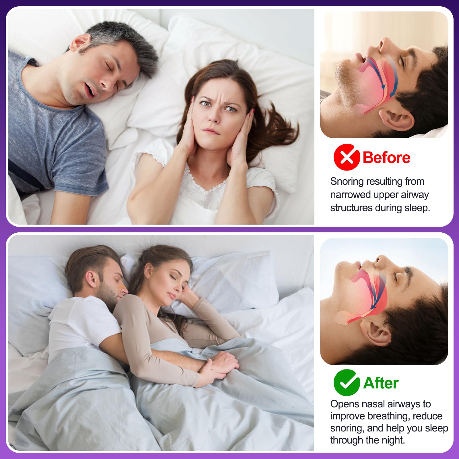 ZenithHome Bandes nasales ventilation optimise: amélioration du passage d’air pendant l’effort.