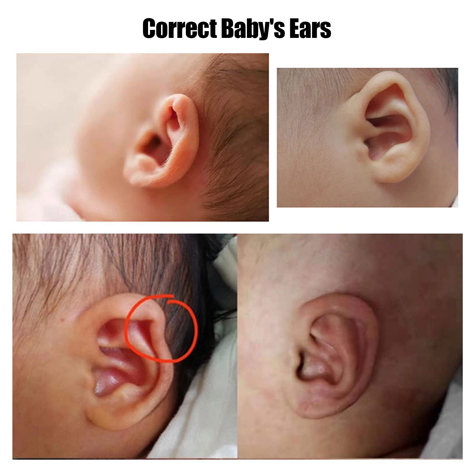 ZJchao patch-correcteur-auriculaire-silicone-enfant-07 léger et discret à porter